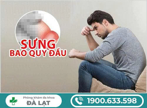 Hình ảnh minh họa